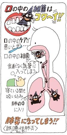 誤嚥性肺炎が起こるメカニズムについて